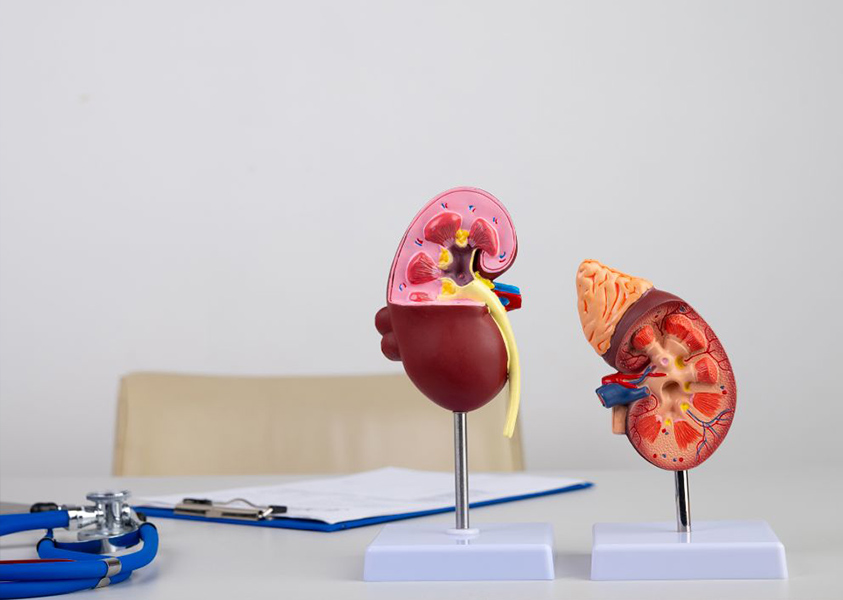 kidney models