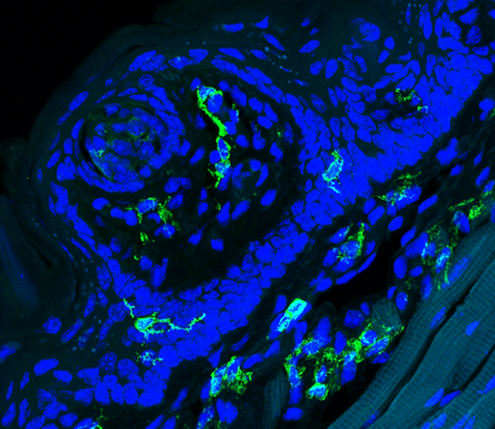 Immune cells (green) invade tate structures in taste-specific ACE2KO