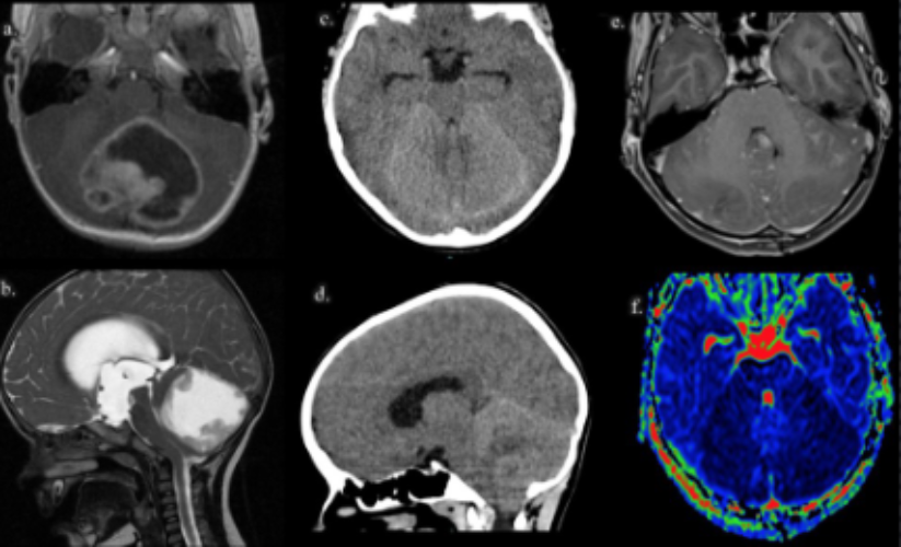 image of brain neurons
